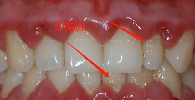 沙皮犬牙齿护理全攻略（从日常护理到专业治疗，让你的沙皮犬健康无忧）