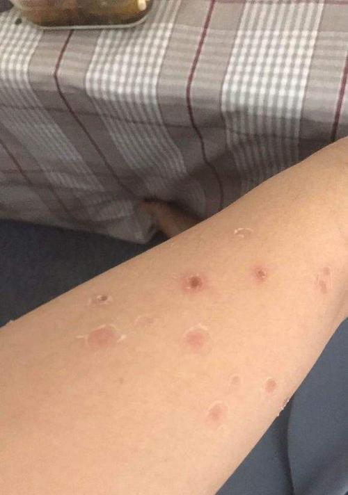 小猫对人的危害大于你想象（不可小觑的小猫威胁——了解这些才能更好地与它们相处）