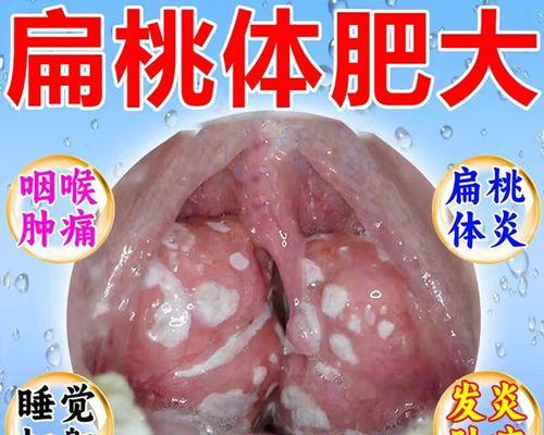 宠物狗也会得扁桃体炎（症状、治疗及预防一览）