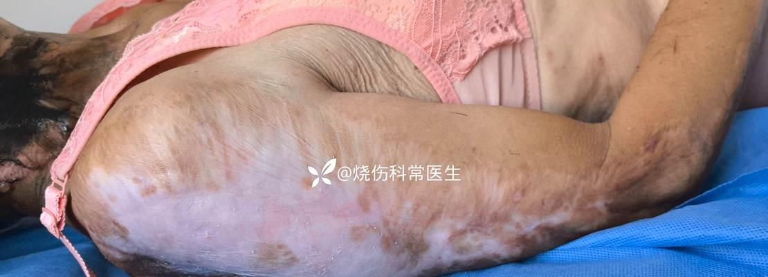狂犬病的传播（探究狂犬病病人发病前多久唾液携带病毒的关键时间点）