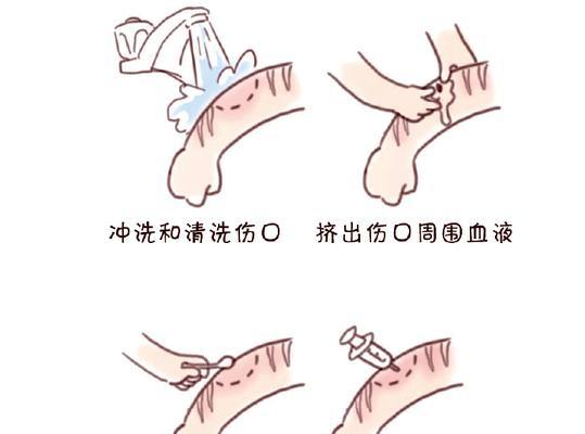 如何清理猫爪子受伤的伤口（用正确步骤处理猫爪子受伤伤口，让猫咪迅速康复）