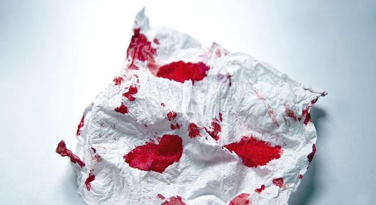 狗狗血液病（了解狗狗血液病的关键知识，保护我们的毛孩健康）