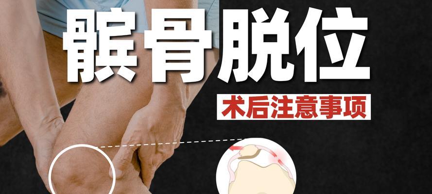 髌骨脱臼后的康复时间及方法（了解康复时间，加快康复进程，重返正常生活）