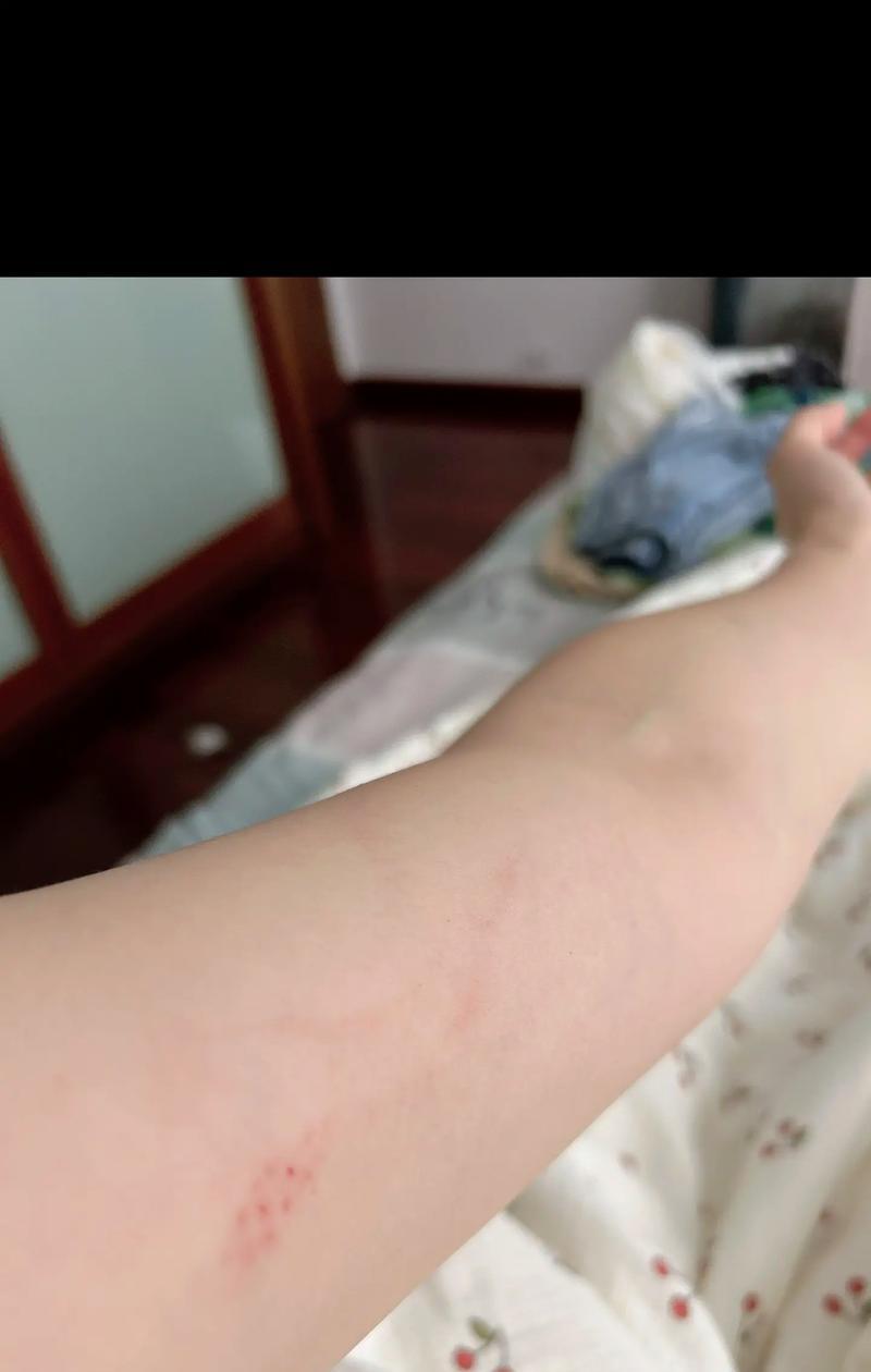 狗狗感染狂犬病的症状和预防措施（了解狂犬病早期症状，保护你的爱犬健康）