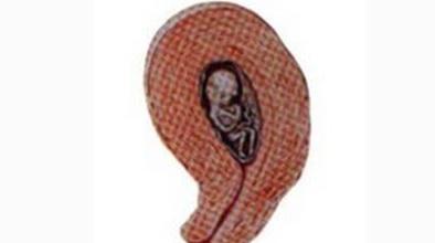 母狗排出死胎的周期和过程（了解母狗排出死胎的关键信息及方法）