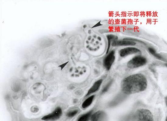 珊瑚死亡背后的真相（探究海洋生态系统中的珊瑚死亡原因，揭示人类活动的影响）