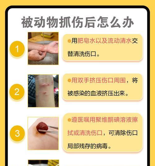 狂犬疫苗注射后的有效期与预防措施（狂犬疫苗的持续保护作用及注意事项）