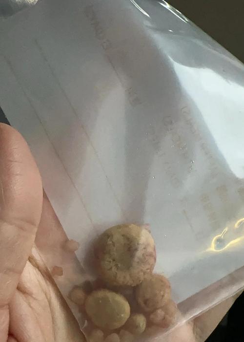 狗狗结石的症状与预防方法（了解狗狗结石的常见症状及如何预防）