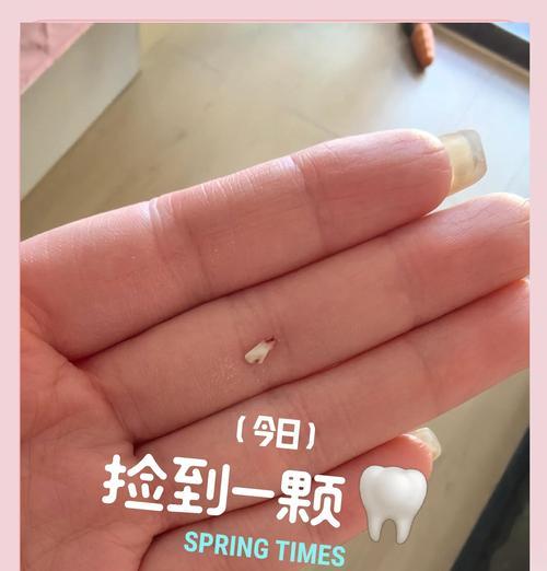 狗狗的换牙期（了解狗狗四个月时的换牙过程和护理方法）