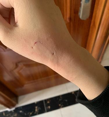 如何处理被猫咪咬伤的情况（应对猫宫庄园中的猫咪咬伤事件，教你正确处理）
