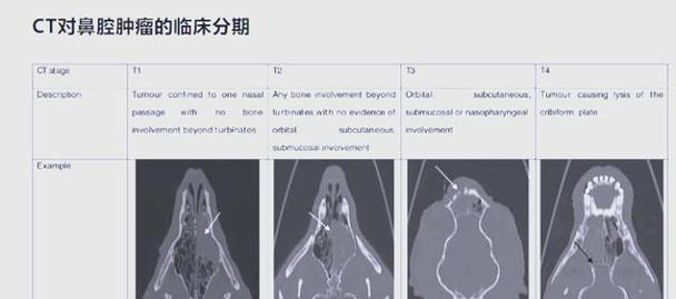 狗狗鼻出血的疾病解析（了解狗狗鼻出血的原因及处理方法）
